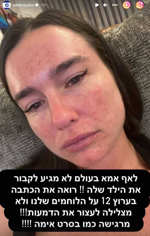 אדל בספלוב יוצאת למתקפה: "פתאום את כזאת מכוערת בעיני"